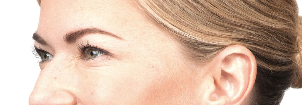 Botox-for-new-site-1170x409