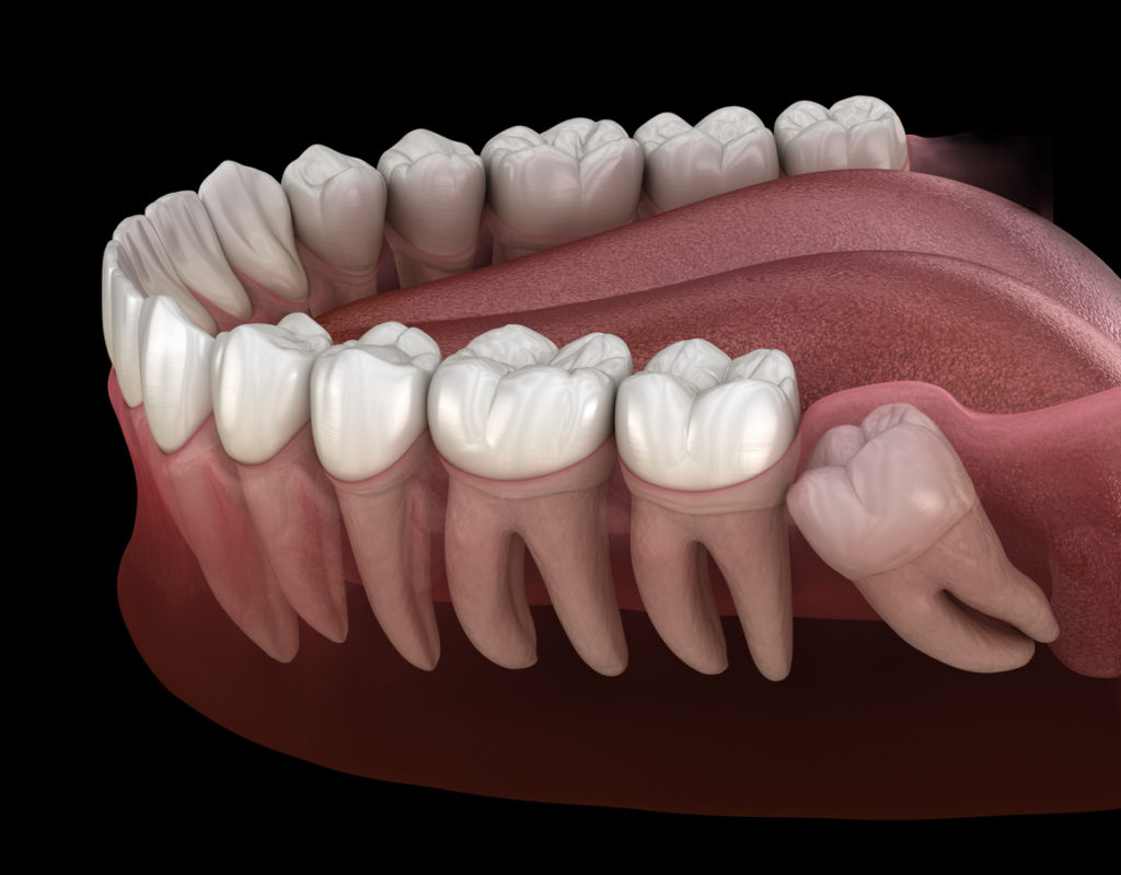 What Age Do Second Molars Come Through